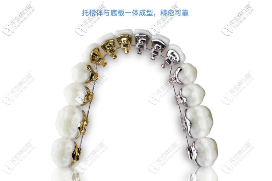 舌側(cè)矯正器