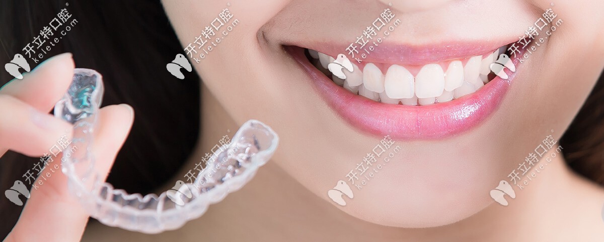 隱形牙套外觀
