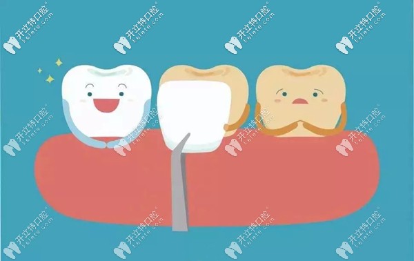 晉城牙科價(jià)目表