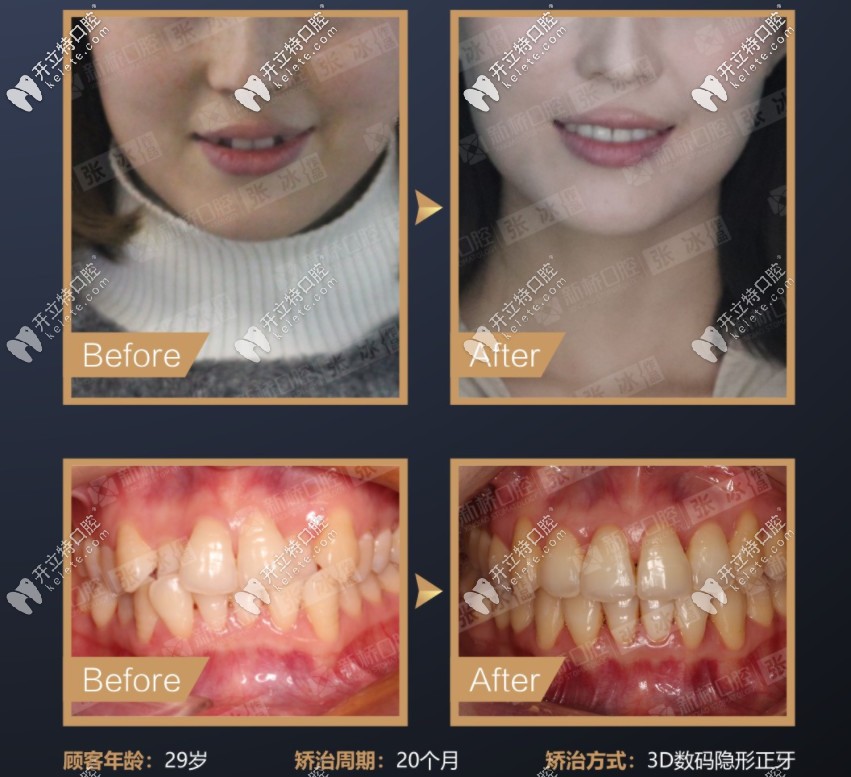 張冰醫(yī)生案例