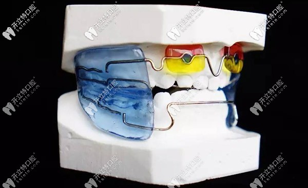 法蘭克3矯正器具體的使用方式與佩戴時(shí)間