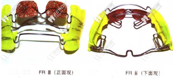 法蘭克3的佩戴流程