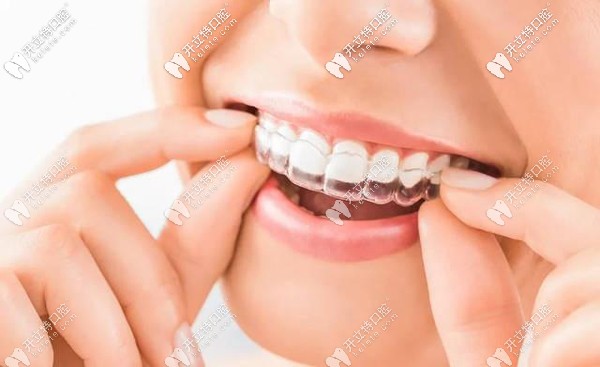 看過南充口腔矯正牙齒收費標(biāo)準(zhǔn)，便知南充箍牙價格多少錢~