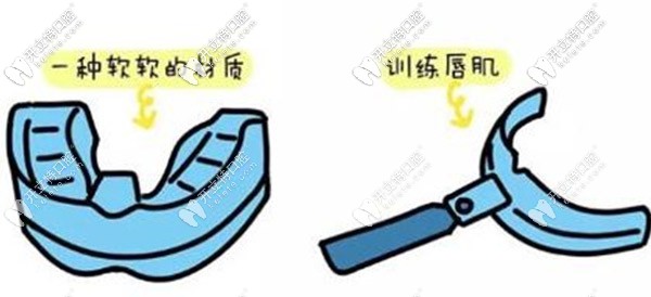 口面肌功能訓(xùn)練器長這樣