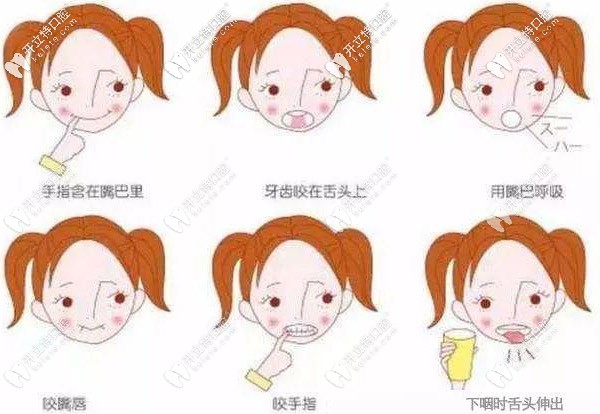 哪些乳牙的情況才適合做早期干預(yù)