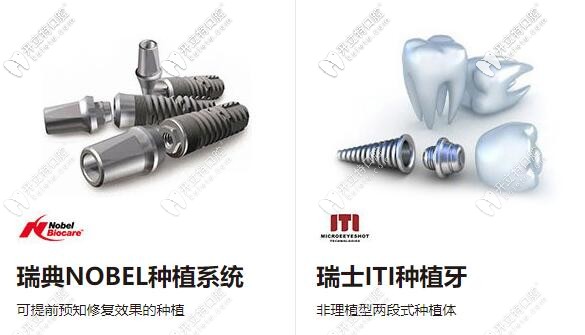 中山好民生口腔合作的高端種植牙品牌：瑞典諾貝爾、瑞士ITI種植體