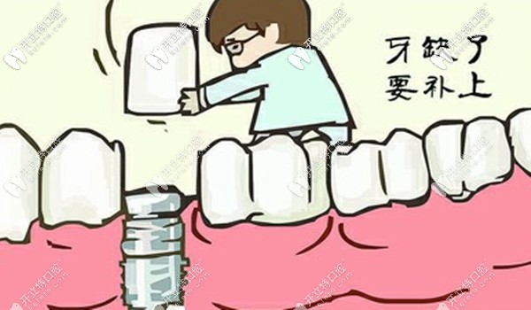 秦浩院長(zhǎng)做滿口種植牙的技術(shù)如何