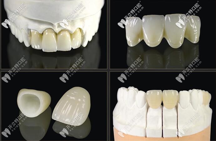 義獲嘉義美展示出來(lái)的效果