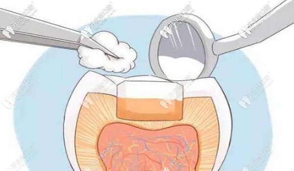 錦州拔牙、洗牙、全瓷牙等牙科項目的價格
