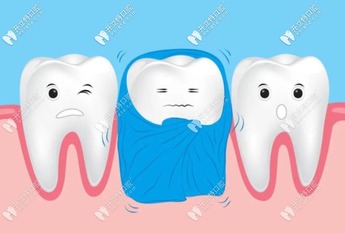 牙齒有黑點但沒有洞需要馬上補(bǔ)嗎？不補(bǔ)的話會一直蔓延？