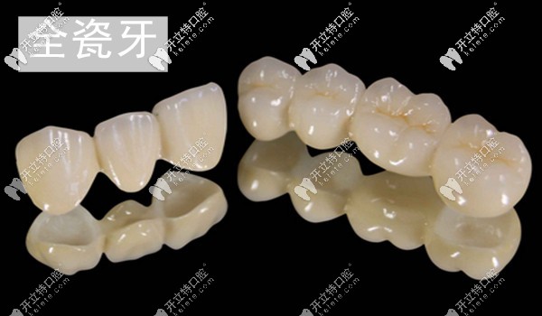 承德可米口腔全瓷牙