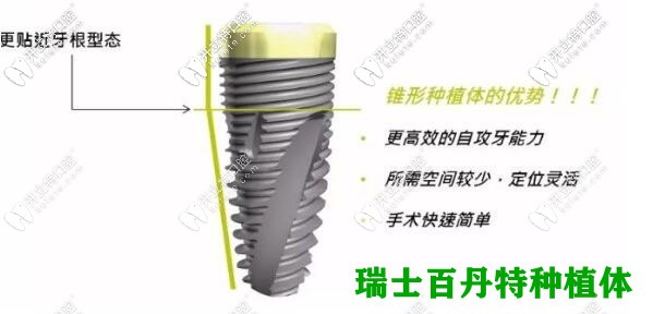 瑞士百丹特種植牙優(yōu)勢(shì)