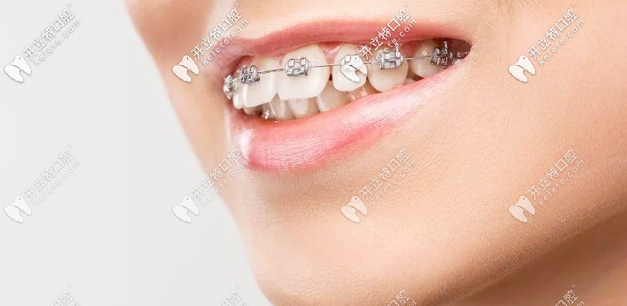 劇透南陽(yáng)口腔醫(yī)院收費(fèi)價(jià)格表，正畸和種牙費(fèi)用還不貴呢