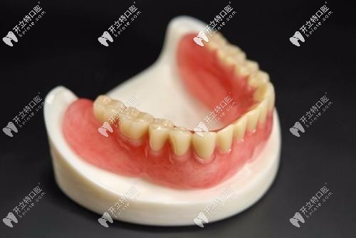 無(wú)掛鉤假牙