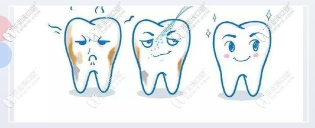 小蘇打刷牙：會有人說變白，只是視覺效果 