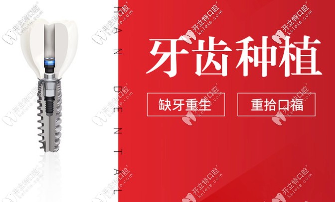 貴陽德韓口腔種植牙怎么樣？種牙技術好的醫(yī)生介紹奉上