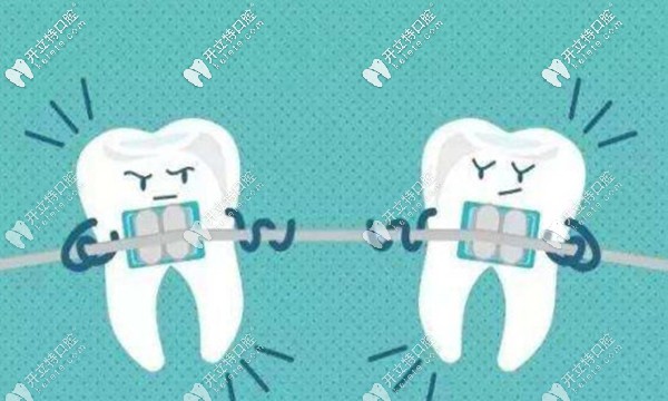 固德口腔戴矯正器的價格