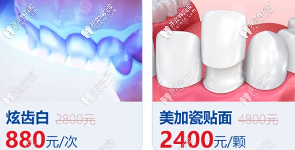 曙光牙科牙齒美白優(yōu)惠詳情