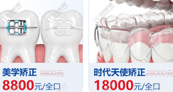 曙光牙科正畸優(yōu)惠活動(dòng)