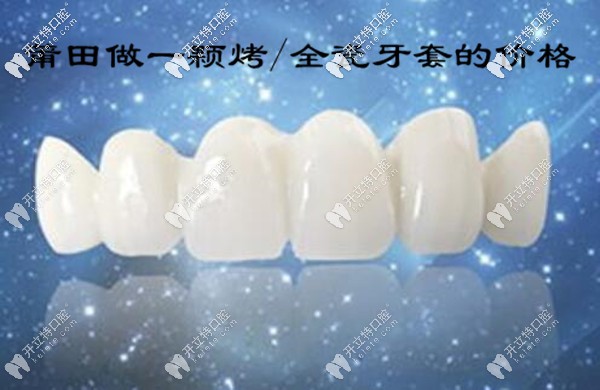 莆田做一顆烤/全瓷牙套的價(jià)格