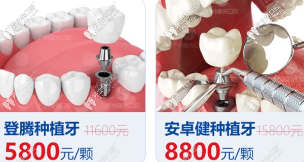 廣州曙光口腔種植牙優(yōu)惠