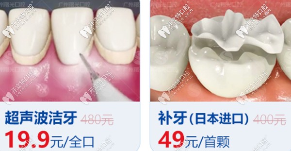 曙光口腔洗牙、補(bǔ)牙優(yōu)惠看這