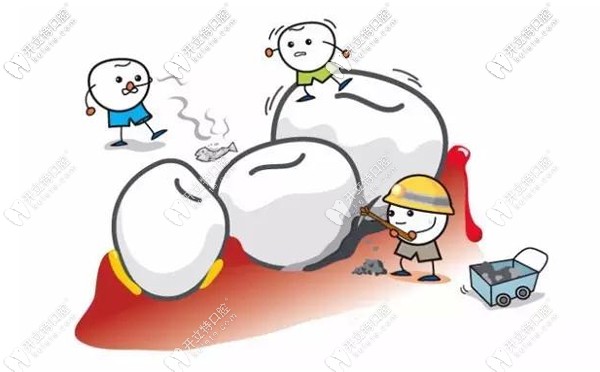 廣州德倫口腔收費(fèi)標(biāo)準(zhǔn)及地址亮相，看牙弄清價(jià)格不迷路哦~