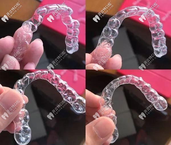 隱形牙套的外觀實拍圖 隱形牙套的外觀實拍圖