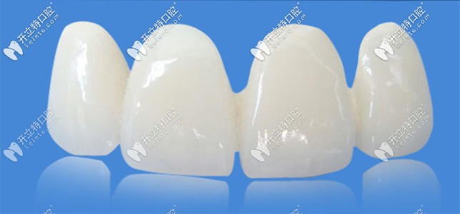全瓷牙冠圖片 全瓷牙冠圖片