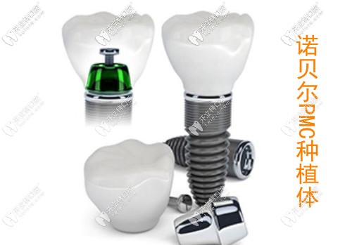 瑞典諾貝爾PMC種植牙