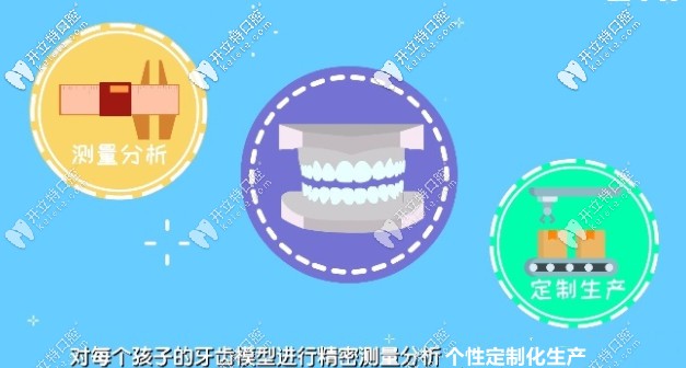 eta牙套進(jìn)行個性定制化生產(chǎn)