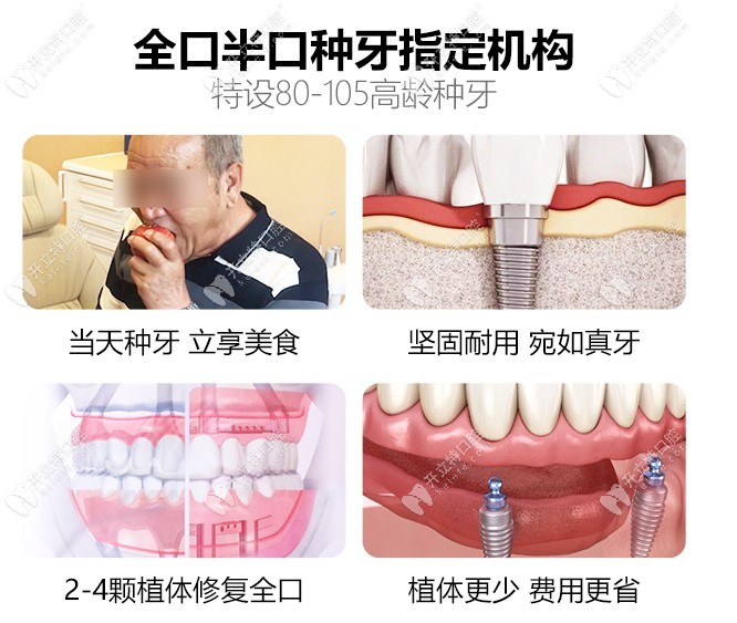 中諾是全口半口種植牙指定機構