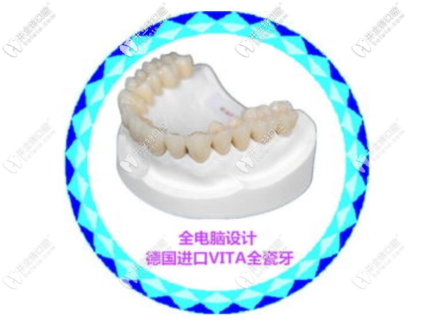 CADCAM設(shè)計(jì)VITA全瓷牙