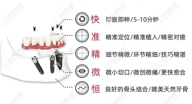 數(shù)字化微創(chuàng)種植牙特點(diǎn)