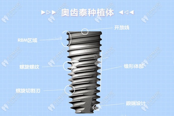奧齒泰種植體怎么樣