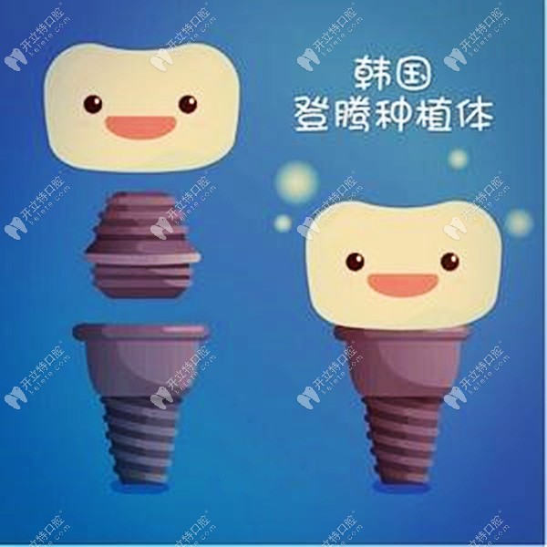 昆明做韓國(guó)純鈦登騰種植牙補(bǔ)貼價(jià)2399元一顆，也太便宜了吧