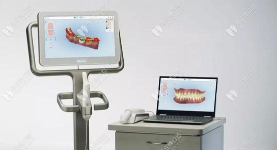 口掃設(shè)備的外觀 口掃設(shè)備的外觀