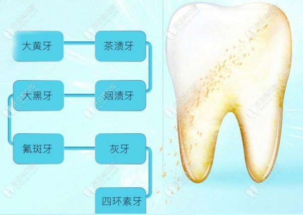 以下這些情況都適合做皓得適美白