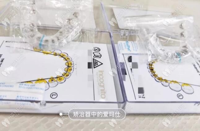 3m黃金incognito舌側隱形矯正價格一般是多少？講講它的優(yōu)缺點