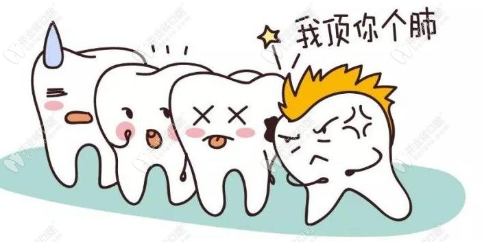 牙齒不齊是一件很痛苦的事