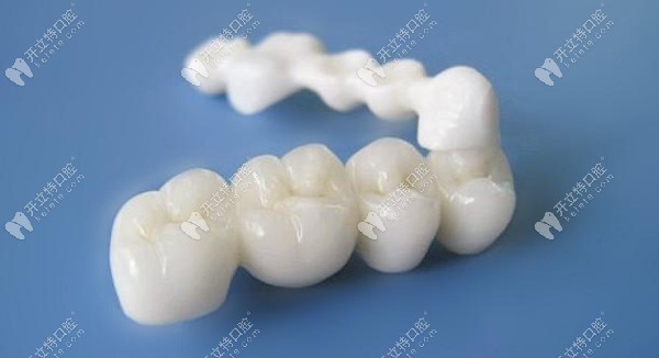 瓷優(yōu)健與瓷倍健全瓷牙區(qū)別