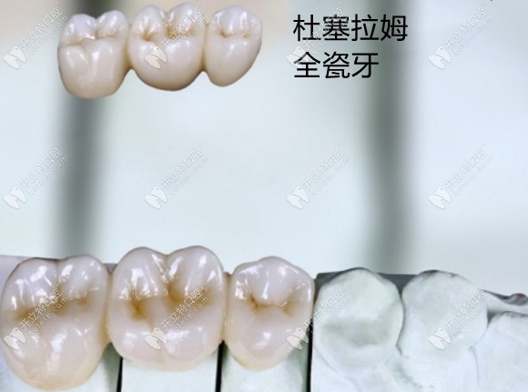 德國(guó)杜塞拉姆樂瓷氧化鋯全瓷牙好還是威蘭德好,你猜對(duì)了嗎