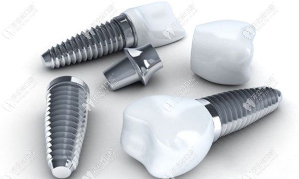 美國皓圣種植牙收費標(biāo)準(zhǔn)