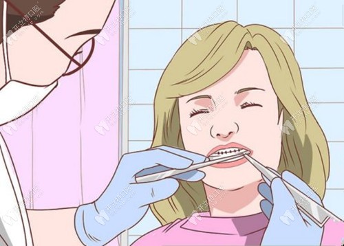 楊醫(yī)生粘托槽的時候十分認真