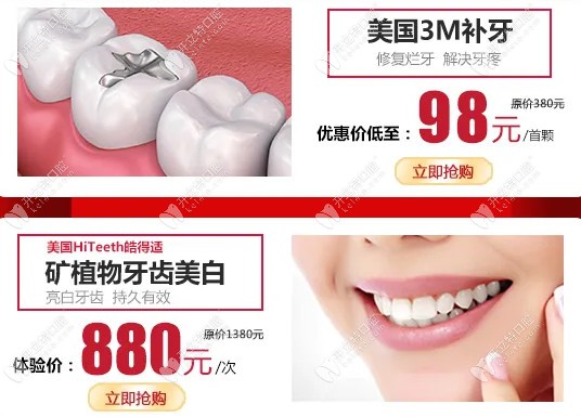 廣州廣大口腔美國3m補牙首顆優(yōu)惠