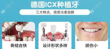 德系ICX種植體的三大特點(diǎn)
