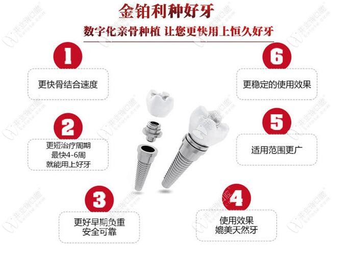 嘉興金鉑利種植牙的優(yōu)勢 嘉興金鉑利種植牙的優(yōu)勢