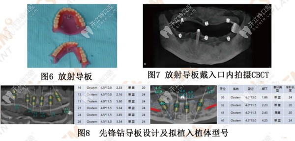 采取的治療計劃