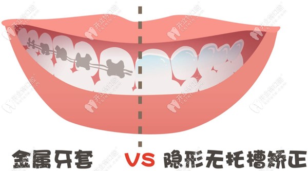 朔州市牙齒矯正參考價格