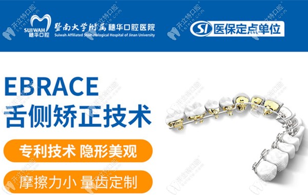 eBrace舌側(cè)隱形正畸的優(yōu)勢(shì)